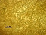 Visione superficiale di un soro di organi pluriloculari